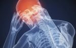 Болит затылок головы: причины, что делать, в висках и шее, лечения