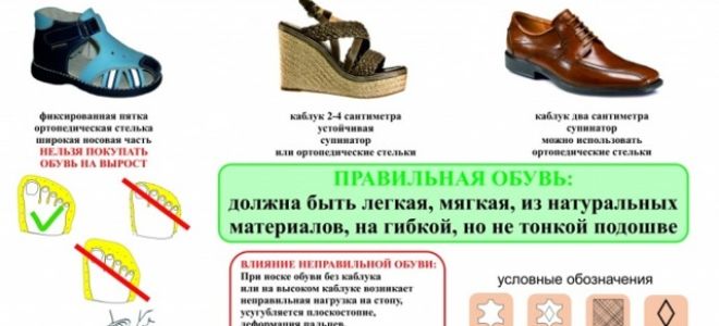 Сколько проходит растяжение связок голеностопа: можно ли ходить
