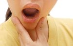 Ожог слизистой рта: лечение, чем лечить, горячим, что делать