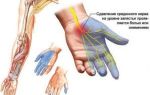 Немеет большой палец на правой руке: причины и лечение
