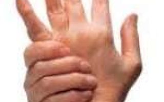 Вывих пальца на руке: что делать, лечение в домашних условиях