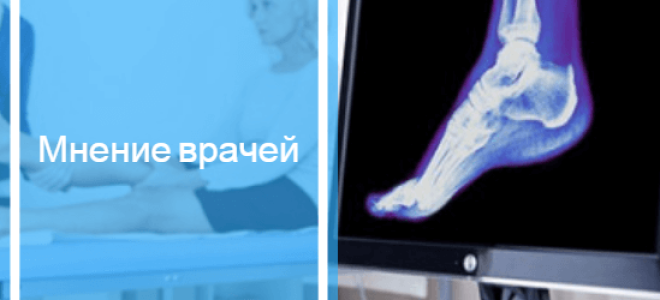 Признаки перелома голеностопа: симптомы, как определить и лечить травму
