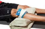 Травма колена, растяжение связок: причины, симптомы и лечение