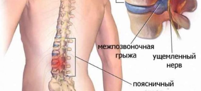 Немеют кончики пальцев на руках: причины, что делать, онемели