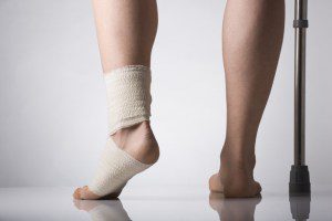 Сколько проходит растяжение связок голеностопа: можно ли ходить
