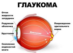 Болят глаза: как будто давят, изнутри, давящая боль