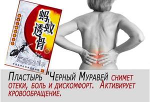 Боль в суставах: китайский пластырь, мазь, причины и лечение