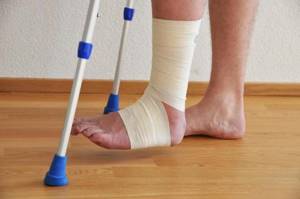 После перелома лодыжки отекает нога: что делать, как лечить