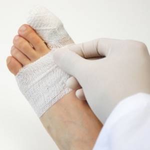 Ушиб пальца на ноге: симптомы, что делать в домашних условиях