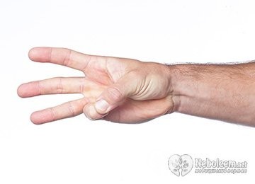 Немеет большой палец на правой руке: причины и лечение