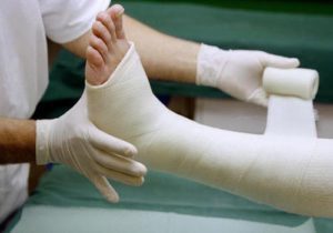 После перелома лодыжки отекает нога: что делать, как лечить