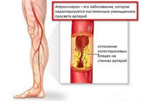 Болят ноги от колена до ступни: боли до стопы, причины, лечение