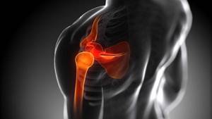 Боль в плечевом суставе левой руки: причины, лечение
