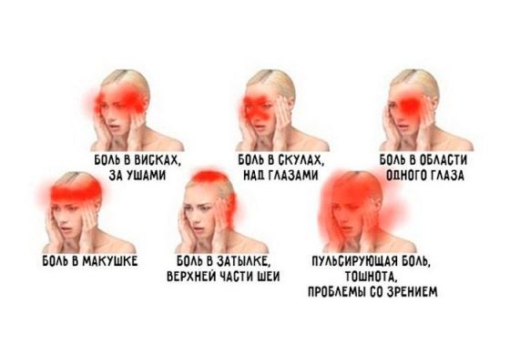 Пульсирующая боль в левой части головы: слева, сбоку, почему
