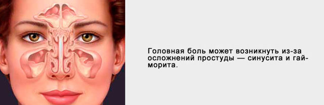 Болит голова при наклоне вниз: наклоняюсь, почему, голованя боль
