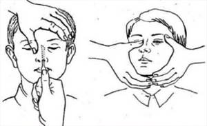 Перелом носа без смещения: костей, спинки, последствия