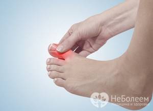 Ушиб пальца на ноге: симптомы, что делать в домашних условиях