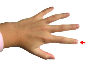 Немеет указательный палец левой руки: причины, что делать