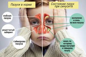 У ребенка болит голова в лобной части без температуры: причины