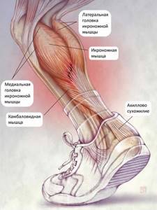 Растяжение мышц на ноге: что делать, как лечить, лечение