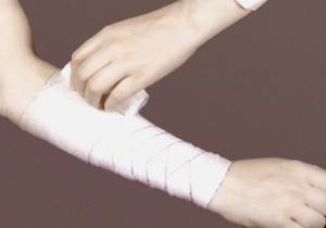 Фиксирующая повязка на руку: при переломе, как сделать, наложение