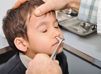 Перелом носа у ребенка: симптомы, признаки