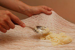 Растяжение связок голеностопного сустава: лечение в домашних условиях