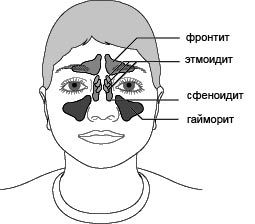 Болит глаз и голова с одной стороны: боль и давит