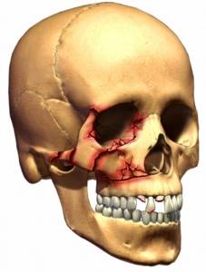 Сочетанная травма: комбинированная, скелета, головы