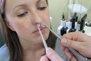 Как вправляют нос после перелома: вправление костей