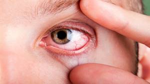 Разрыв сетчатки глаза: серьезно ли это, причины, лечение