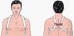 Болит ключица: боль справа, слева, что делать, отдающая в шею, плечо