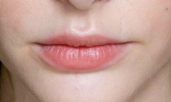 Немеют губы и язык: причины, почему онемели, лечение