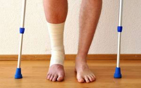 Вывих ноги в районе щиколотки: лечение в домашних условиях