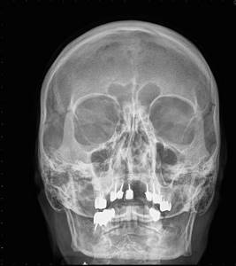 Сочетанная травма: комбинированная, скелета, головы