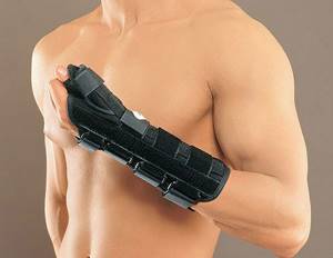 Ортез на руку при переломе лучевой кости: бандаж, лангетка