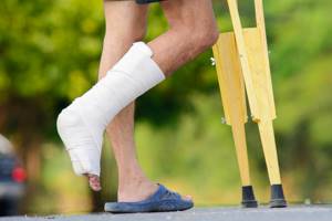 Как правильно ходить на костылях при переломе лодыжки: с одним костылем