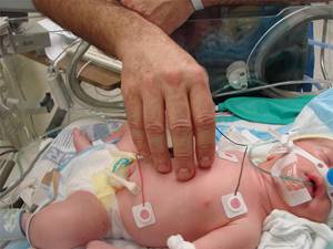 Родовая травма у новорожденных: повреждения позвоночника у детей