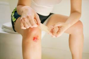 Травма колена при падении: лечение, что делать, в домашних условиях