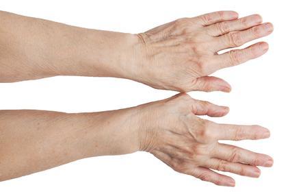 Болят пальцы рук при сгибании: сгибы, утром, причины