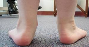 Болят икры ног: у женщин, у мужчин, причины, от чего