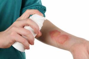 Лечение гнойных ран: антибиотики, как лечить, загноение