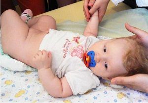 Подвывих шейного позвонка у ребенка: ротационный, новорожденных