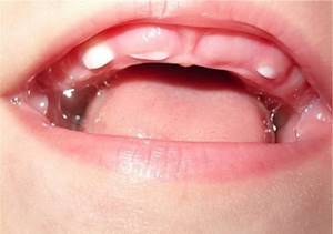 Обезболивающая мазь для зубов: взрослым, зубная, гель, для десен