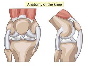 Повреждение мениска коленного сустава: симптомы и лечение