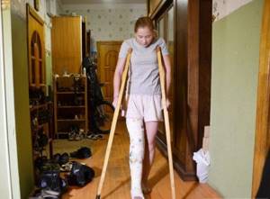 Как правильно ходить на костылях при переломе лодыжки: с одним костылем