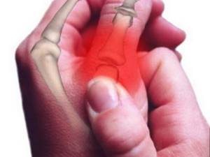 Болят суставы пальцев рук: причины и лечение, боли, что делать