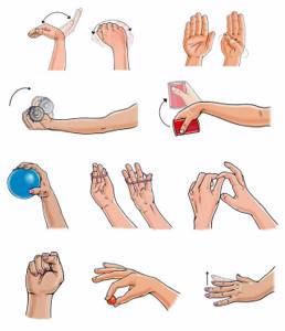 Как разработать руку после перелома лучевой кости в домашних условиях