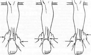 Удаление позиционного винта при переломе лодыжки: снятие