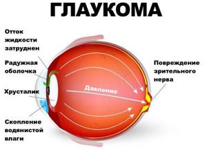 Болит глаз при движении: почему боль внутри глазного яблока